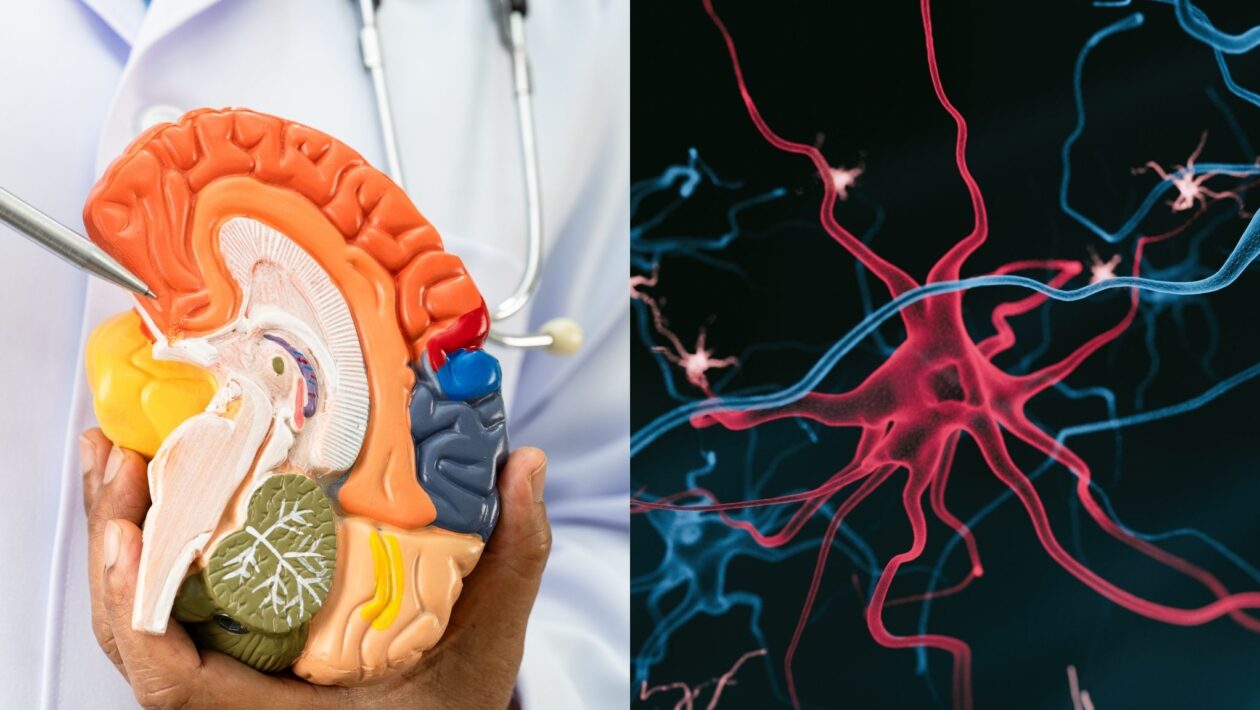 Autópsias revelam inflamação precoce em cérebros com Alzheimer. (Foto: Pamai's Images via Canva)