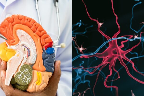 Autópsias revelam inflamação precoce em cérebros com Alzheimer. (Foto: Pamai's Images via Canva)