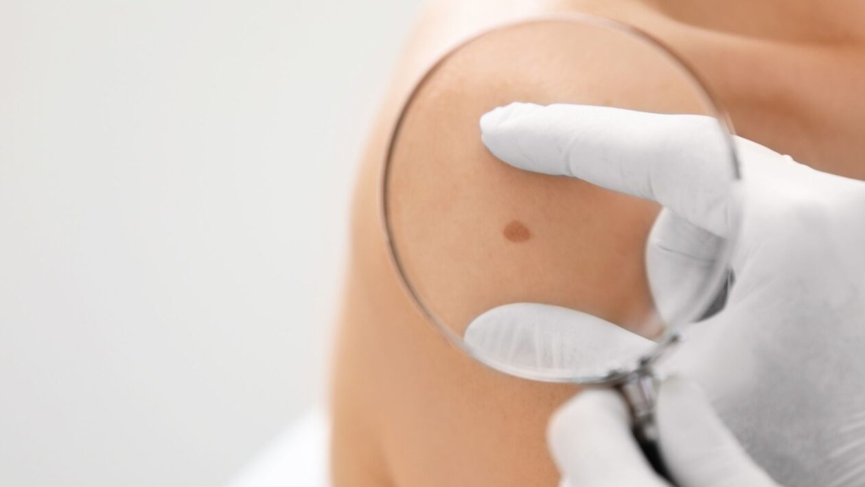 Dezembro Laranja reforça prevenção e autocuidado diário. (Foto: Pixelshot via Canva)