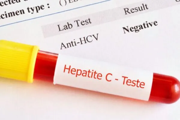 Novo teste detecta hepatite C em apenas 15 minutos. (Foto: Getty Images via Canva)
