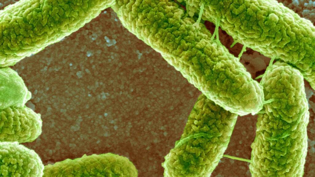 MEV colorida mostra E. coli conectadas por estruturas chamadas pili (Imagem: Photo Library via Canva)
