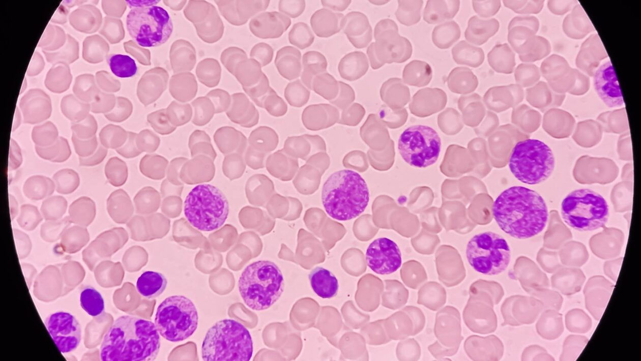 IA detecta células sanguíneas perigosas com precisão inédita (Imagem: Getty Images/ Canva Pro)