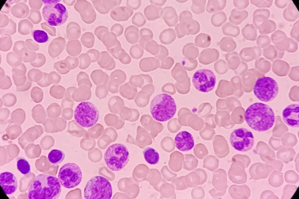 IA detecta células sanguíneas perigosas com precisão inédita (Imagem: Getty Images/ Canva Pro)