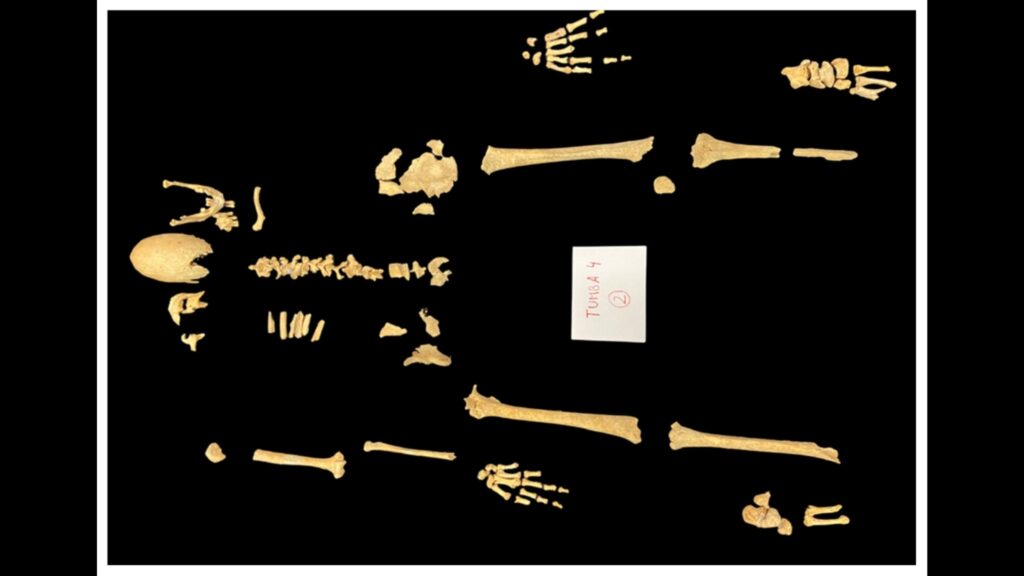 Restos do esqueleto T4.2 encontrados no cemitério do Pátio dos Condes, castelo de Zorita de los Canes (Imagem: Rissech et al, Heritage (2025), CC BY 4.0)
