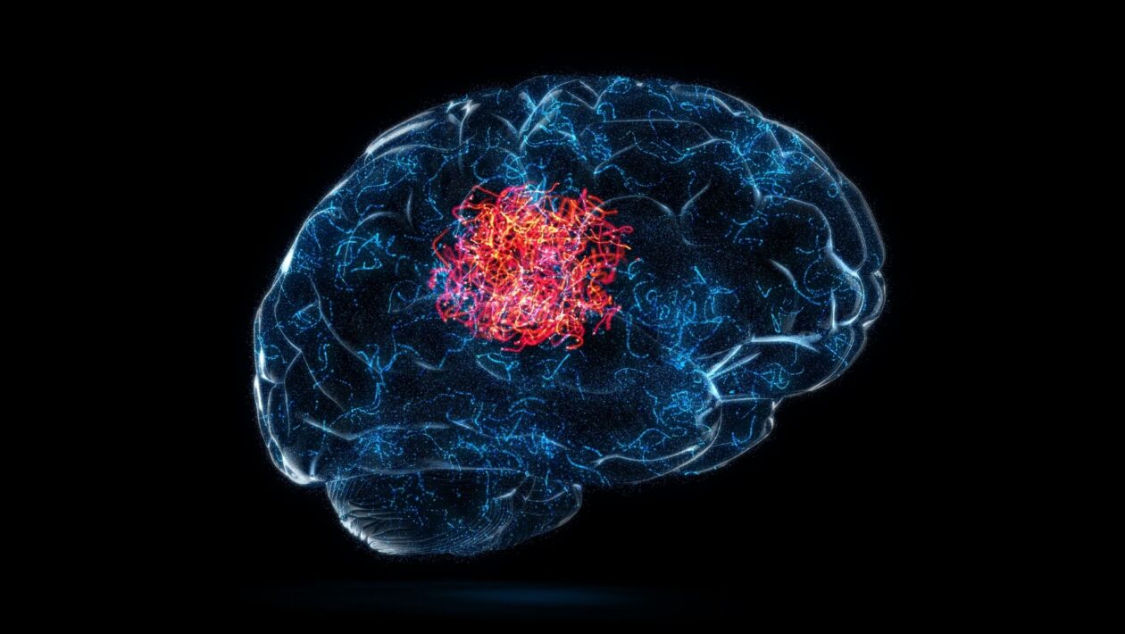 Tumor cerebral pode começar em células aparentemente normais. (Foto: Getty Images via Canva)