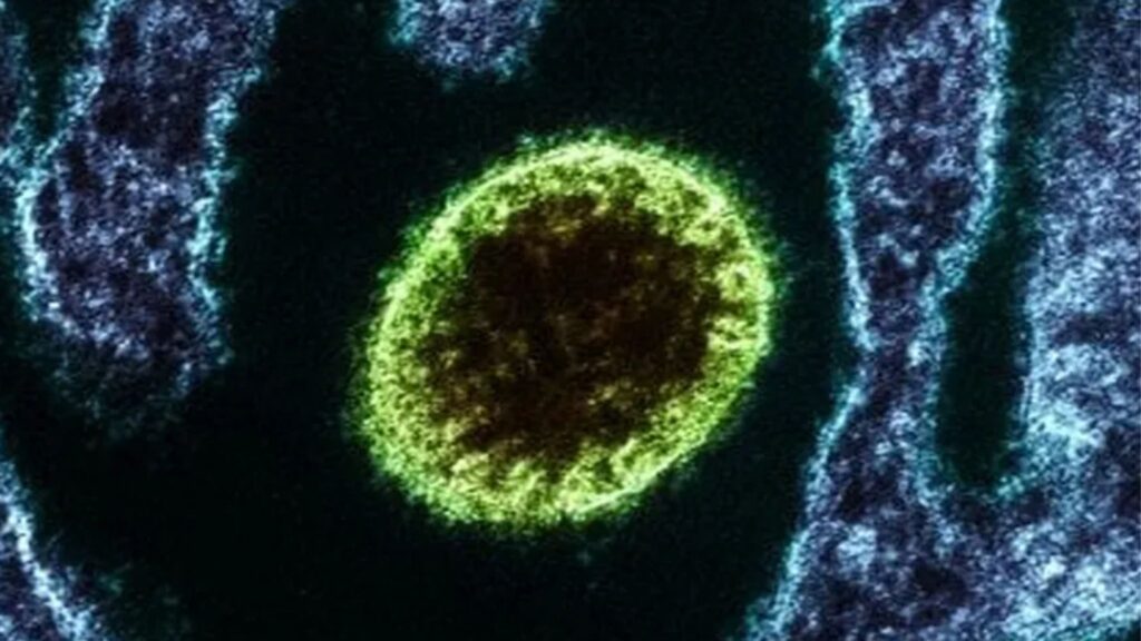 Registro microscópico do vírus Nipah durante análise laboratorial. (Foto: Reprodução / Instituto Nacional de Alergia e Doenças Infecciosas dos EUA)