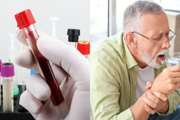 Sinais do Parkinson aparecem no sangue antes dos sintomas. (Foto: Nenov brothers e Pixelshot via Canva)