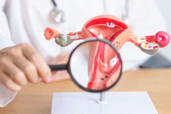 Endometriose pode ser identificada anos antes com exame simples. (Foto: Getty Images via Canva)