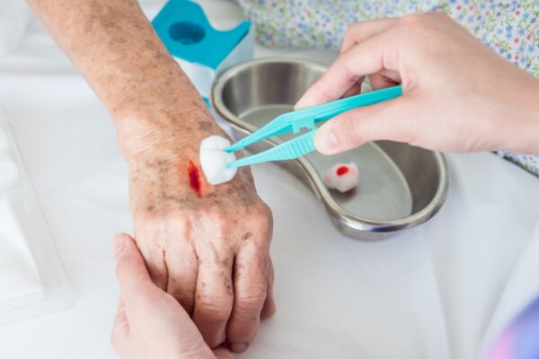 Antibióticos nem sempre resolvem feridas que não fecham. (Foto: Getty Images via Canva)