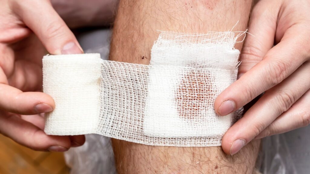 Antioxidantes podem destravar a cicatrização da pele. (Foto: Getty Images via Canva)