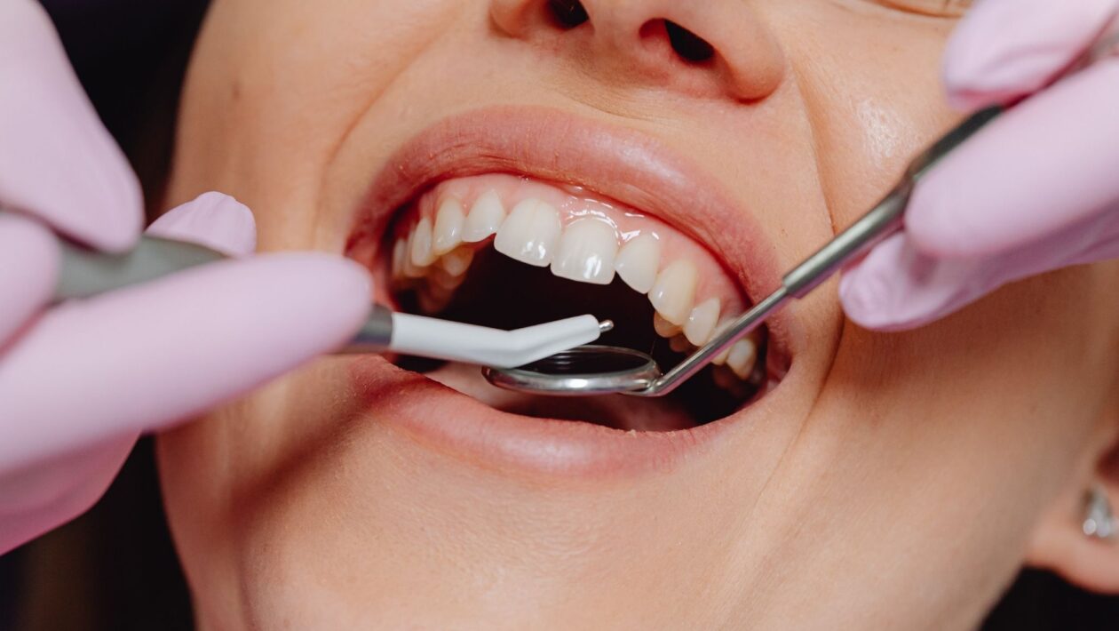 Boca desequilibrada aumenta risco de enxaqueca e fibromialgia. (Foto: Pexels via Canva)