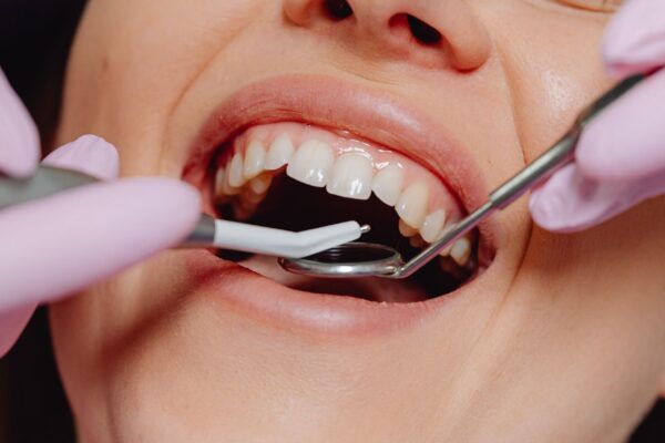 Boca desequilibrada aumenta risco de enxaqueca e fibromialgia. (Foto: Pexels via Canva)