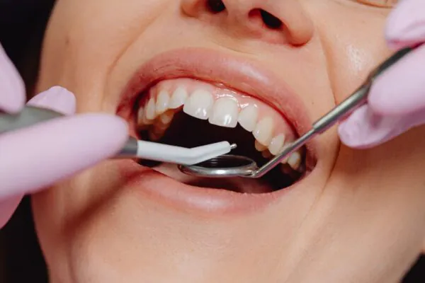 Boca desequilibrada aumenta risco de enxaqueca e fibromialgia. (Foto: Pexels via Canva)