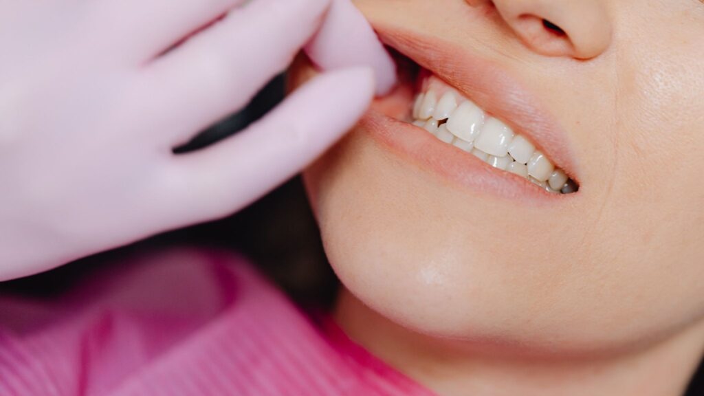 Microbioma oral influencia diretamente a sensibilidade à dor. (Foto: Pexels via Canva)