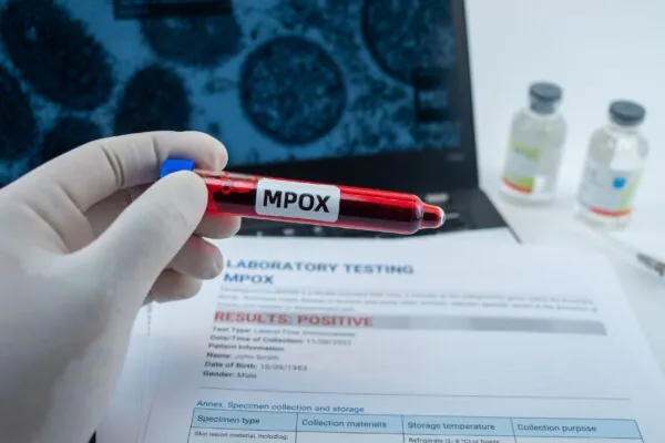 Segundo caso de Mpox reforça alerta em São Paulo. (Foto: Getty Images via Canva)
