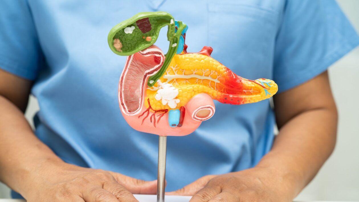 Novo alvo molecular pode enfraquecer o câncer de pâncreas. (Foto: Pamai's Images via Canva)