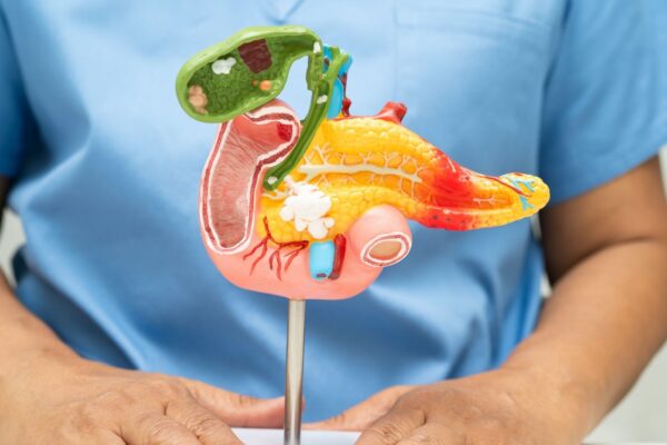 Novo alvo molecular pode enfraquecer o câncer de pâncreas. (Foto: Pamai's Images via Canva)