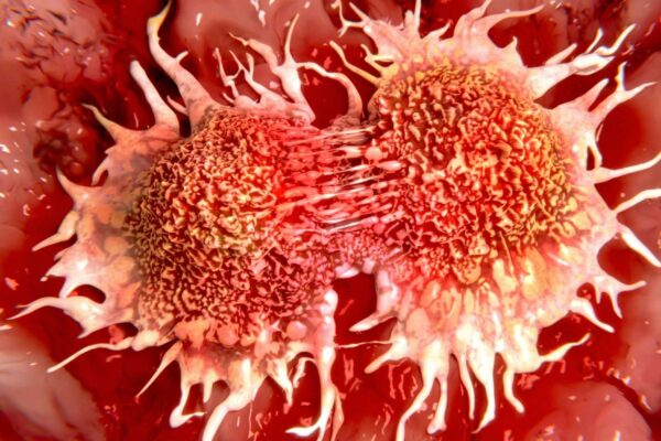 Novo avanço pode tornar terapias celulares contra o câncer mais acessíveis (Imagem: Getty Images/ Canva Pro)