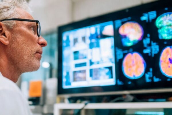 Exames cerebrais ajudam a prever resposta ao tratamento da depressão. (Foto: Handmadefont via Canva)