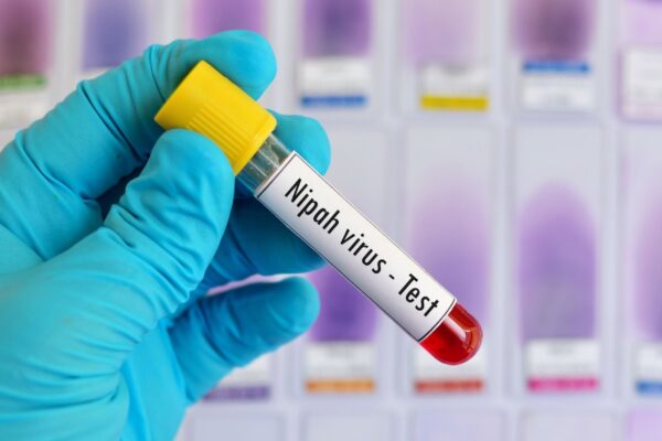 Vírus Nipah tem alta letalidade e preocupa autoridades de saúde. (Foto: Getty Images via Canva)