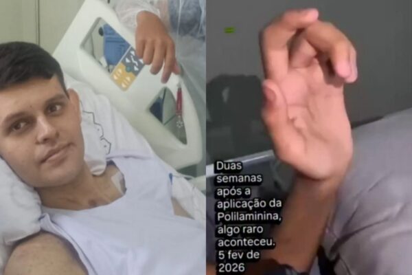 Luiz Otávio avança após dose experimental com Polilaminina. (Foto: Reprodução / Instagram)