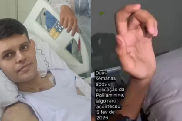 Luiz Otávio avança após dose experimental com Polilaminina. (Foto: Reprodução / Instagram)