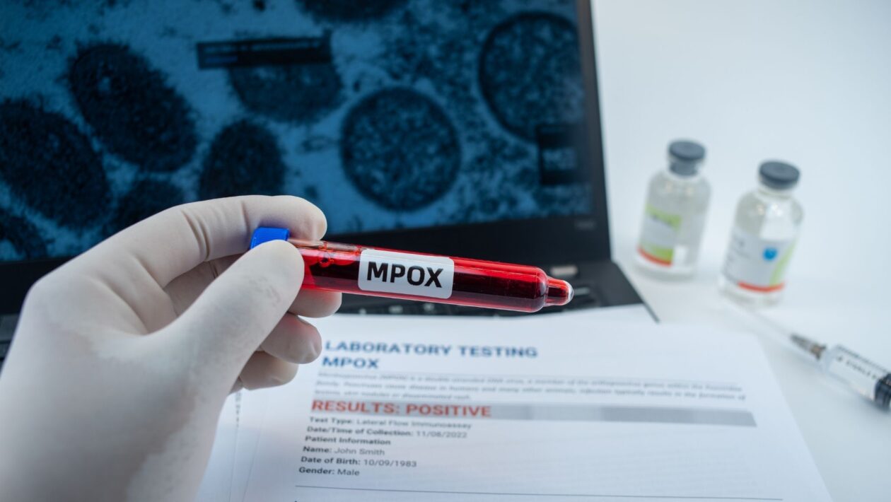 Recombinação genética dá origem a nova variante de mpox. (Foto: Getty Images via Canva)