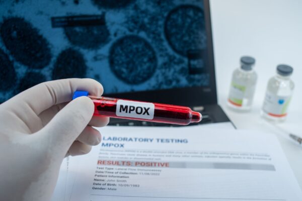 Recombinação genética dá origem a nova variante de mpox. (Foto: Getty Images via Canva)