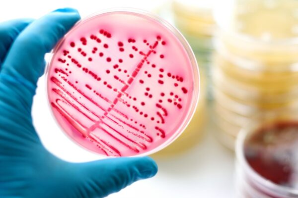 Açúcar bacteriano vira novo alvo contra superbactérias. (Foto: Getty Images via Canva)