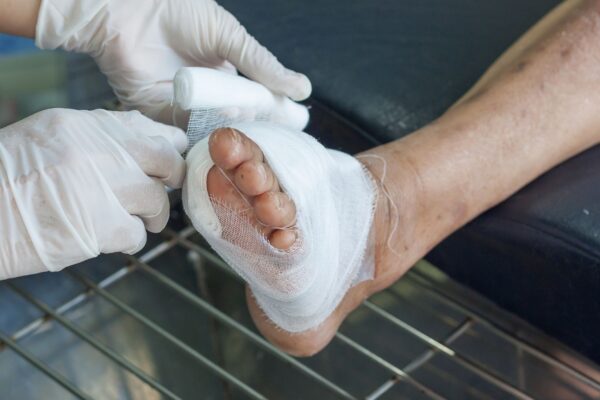 Novo curativo atua contra hipóxia tecidual. (Foto: Getty Images via Canva)