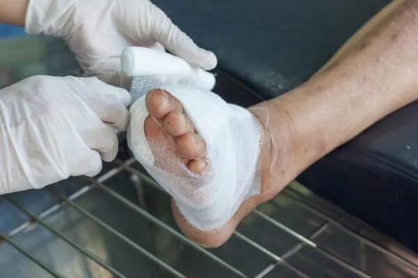 Novo curativo atua contra hipóxia tecidual. (Foto: Getty Images via Canva)