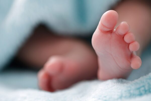 Fenilcetonúria exige controle desde o nascimento. (Foto: Getty Images via Canva)