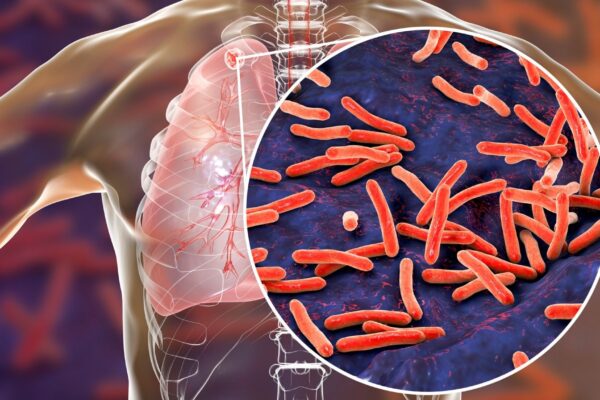 Nanotecnologia eliminou tuberculose em camundongos. (Foto: Photo Library via Canva)