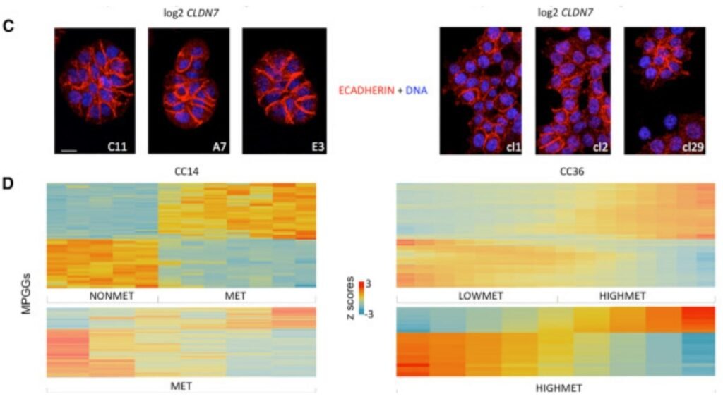 Imagens mostram variações celulares ligadas ao risco de metástase. (Foto: Aravind Srinivasan et al via Cell Reports)