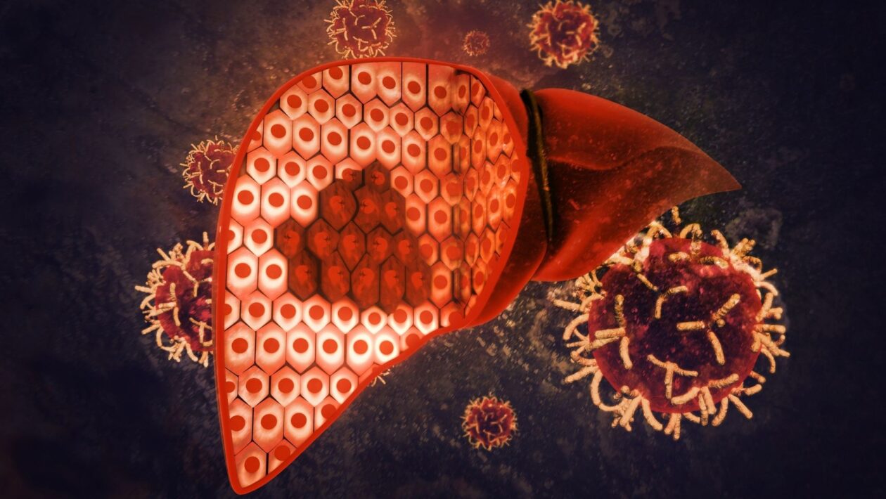 Reduzir proteína na dieta pode retardar câncer de fígado. (Foto: Getty Images via Canva)