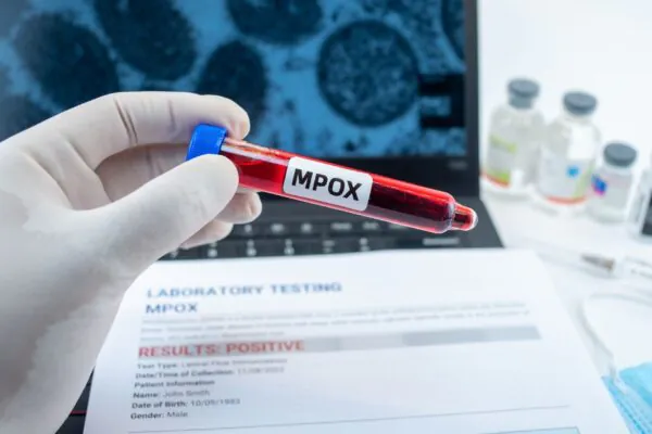 Casos de mpox crescem e vigilância é reforçada. (Foto: Getty Images via Canva)