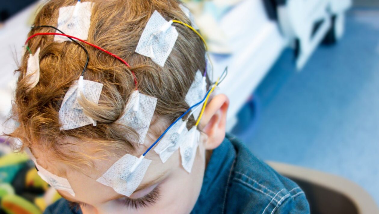 Novo remédio pode reduzir crises de epilepsia resistente. (Foto: Getty Images via Canva)