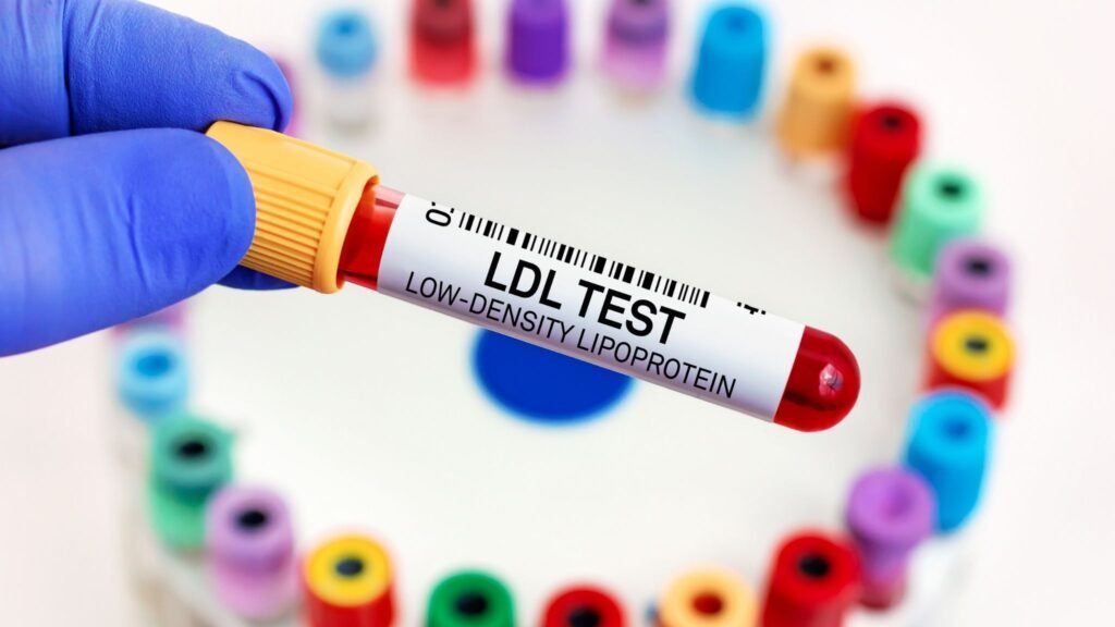 Controlar LDL pode evitar primeiro infarto. (Foto: Getty Images via Canva)