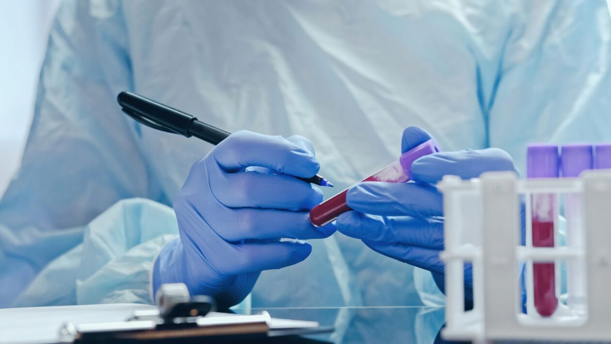 Proteínas do sangue podem indicar risco de Alzheimer. (Foto: Getty Images via Canva)