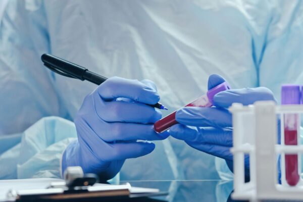 Proteínas do sangue podem indicar risco de Alzheimer. (Foto: Getty Images via Canva)