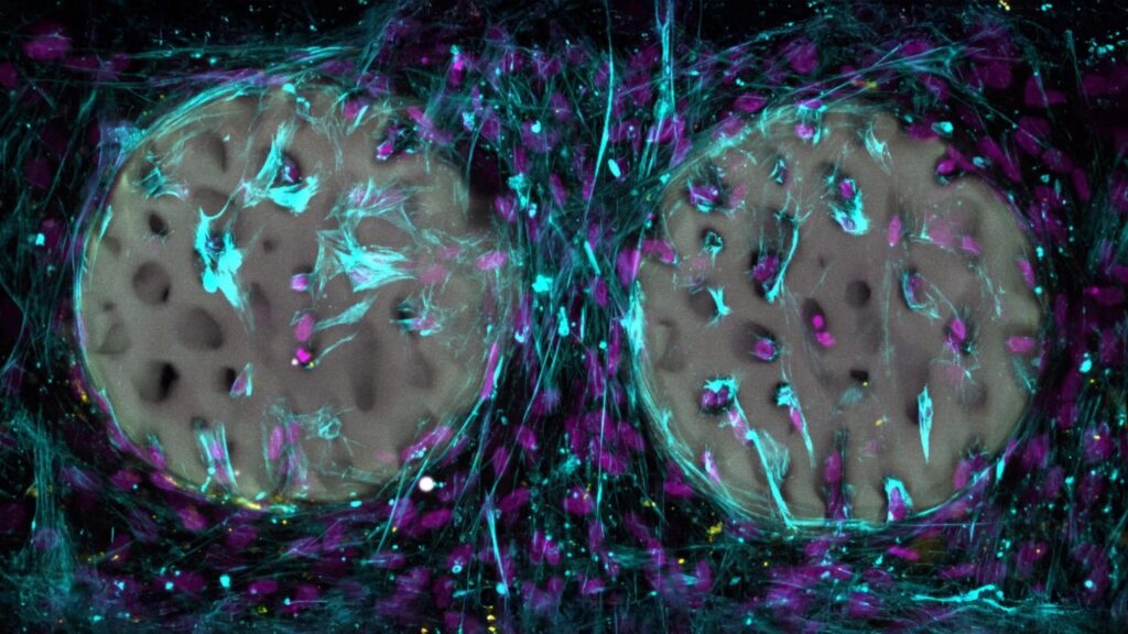Células ósseas produzem colágeno em hidrogel. (Foto: Xiao-Shua Qin / ETH Zurich)