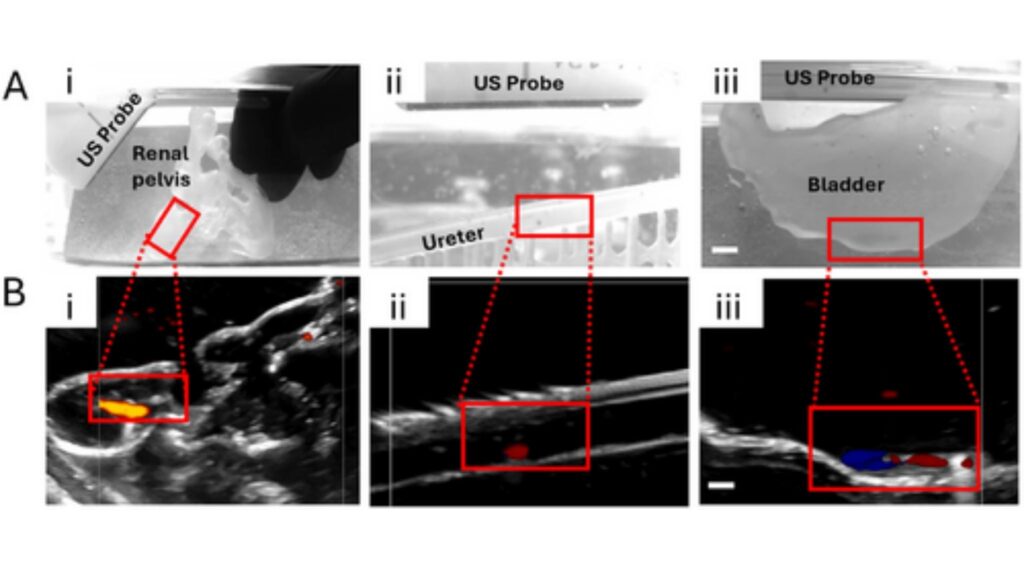 Ultrassom em tempo real mostra robôs em tecidos renais e na bexiga. (Foto: A.Khabbazian et al via Adv. Healthcare Mater)