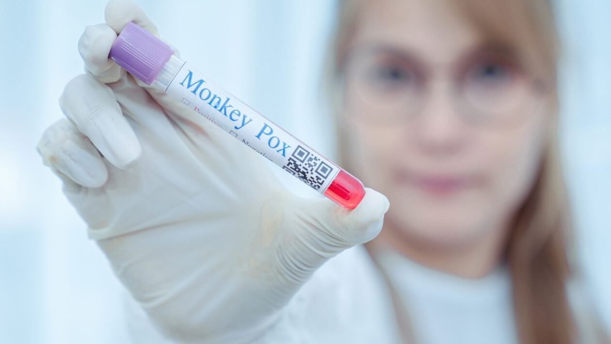 Brasil registra 149 casos de mpox monitorados em 2026. (Foto: Getty Images via Canva)