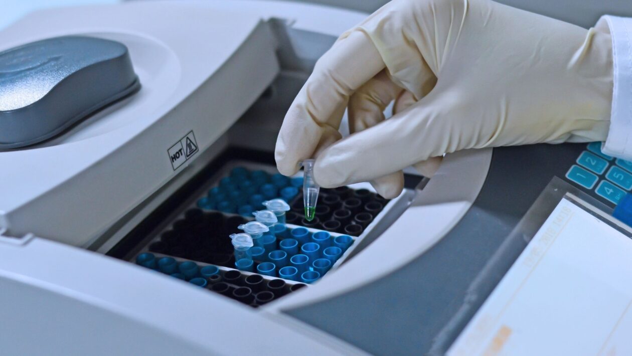 Exame de PCR ajuda a detectar infecções e inflamações. (Foto: Getty Images via Canva)