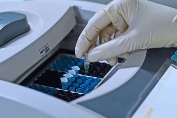 Exame de PCR ajuda a detectar infecções e inflamações. (Foto: Getty Images via Canva)