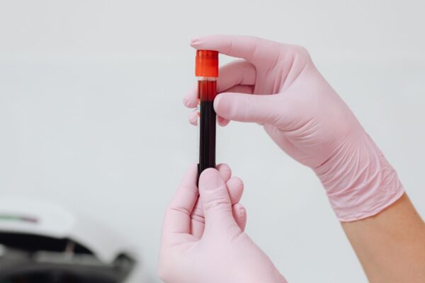 Descoberta revela defesa natural contra fungos perigosos. (Foto: Pexels via Canva)