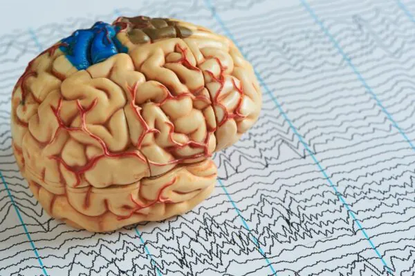 Estudo clínico melhora qualidade de vida de crianças com Dravet. (Foto: Getty Images via Canva)