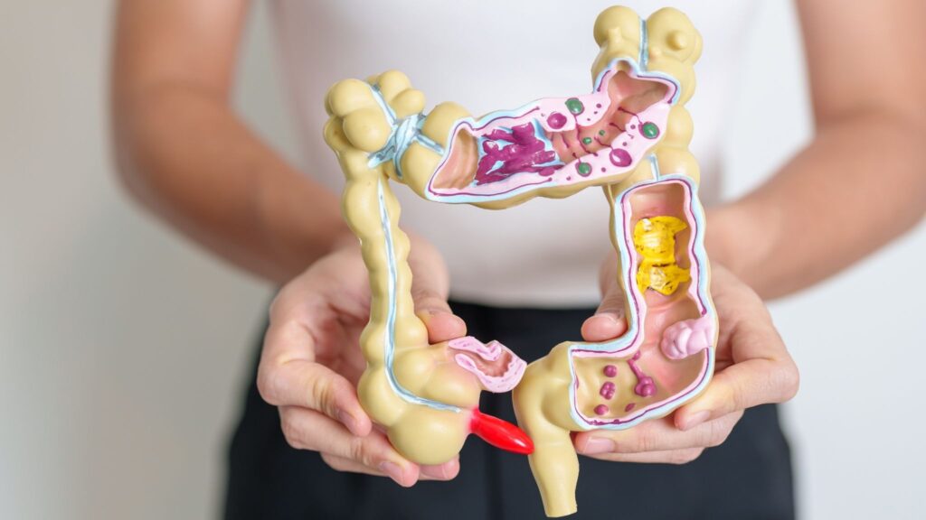 Mudanças no intestino podem surgir sem sintomas. (Foto: Getty Images via Canva)