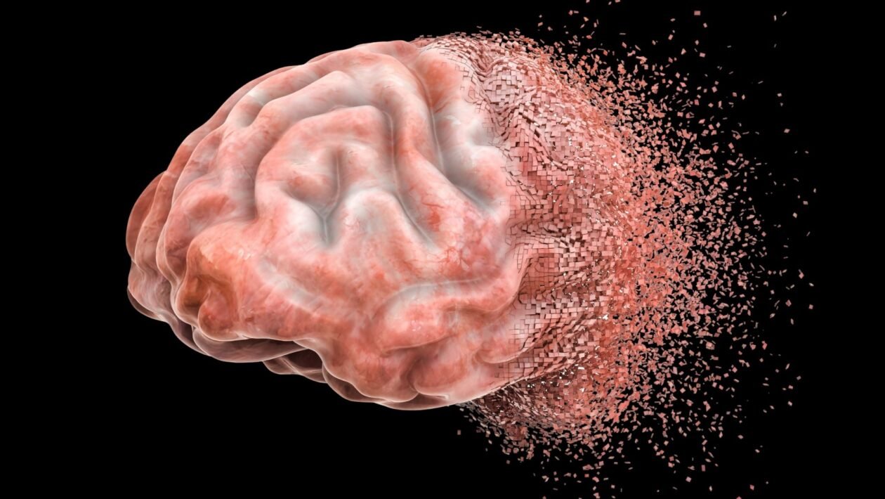 Nova técnica revela avanço do Alzheimer. (Foto: Getty Images via Canva)