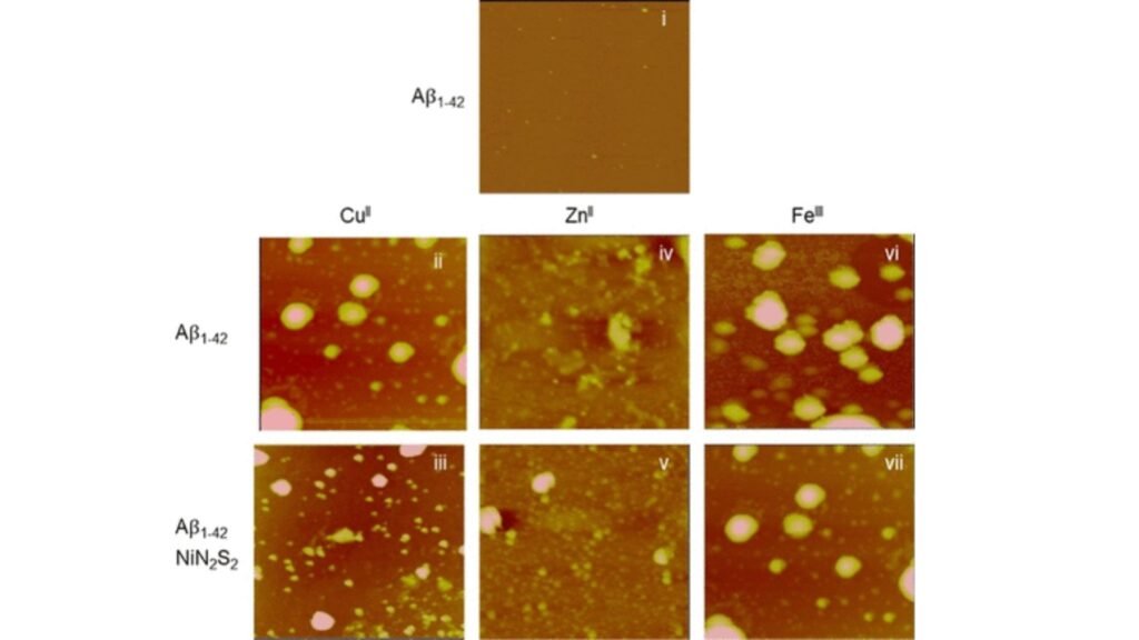Imagens AFM mostram agregação da proteína Aβ com metais e quelante. (Imagem adaptada: Alyssa N. Schroeder et al via ACS Omega)